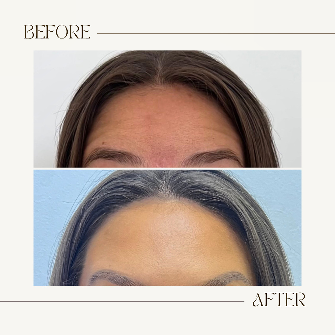 Beige Brown Neutral Before + After Instagram Post - 1