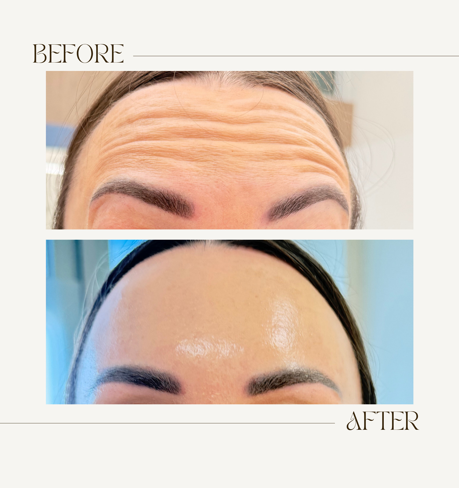 Beige Brown Neutral Before + After Poster - 1